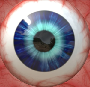 detached vitreous and aging can cause eye floaters 